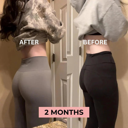 🎁 [FREE GIFT BUNDLE] ToneUp™ Glutes Trainer